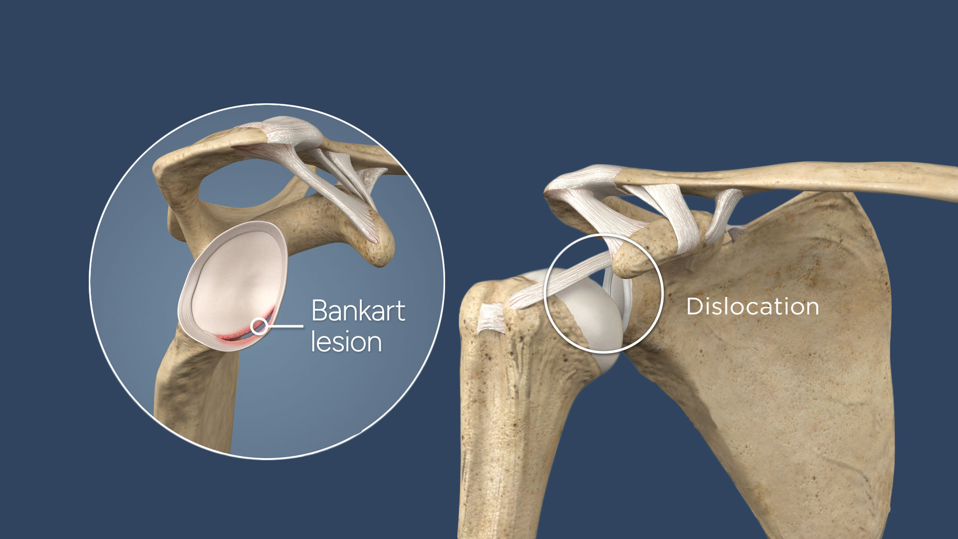 2026 Update “Ugghhh”